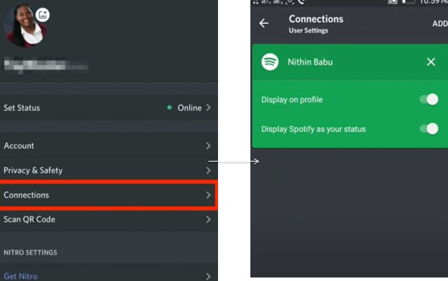 connect Discord to Spotify
